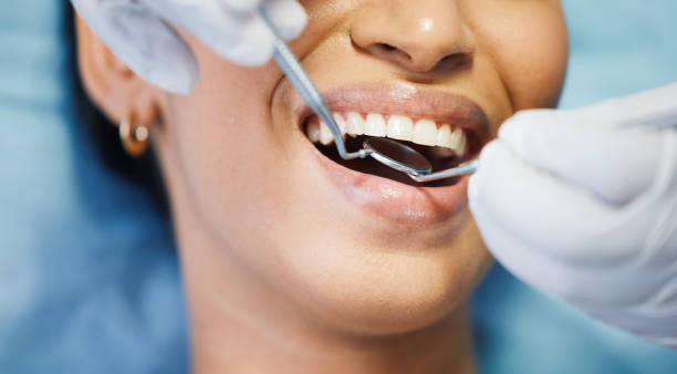 Best Emergency Wisdom Teeth Removal in Orida Gulf Coast University, FL